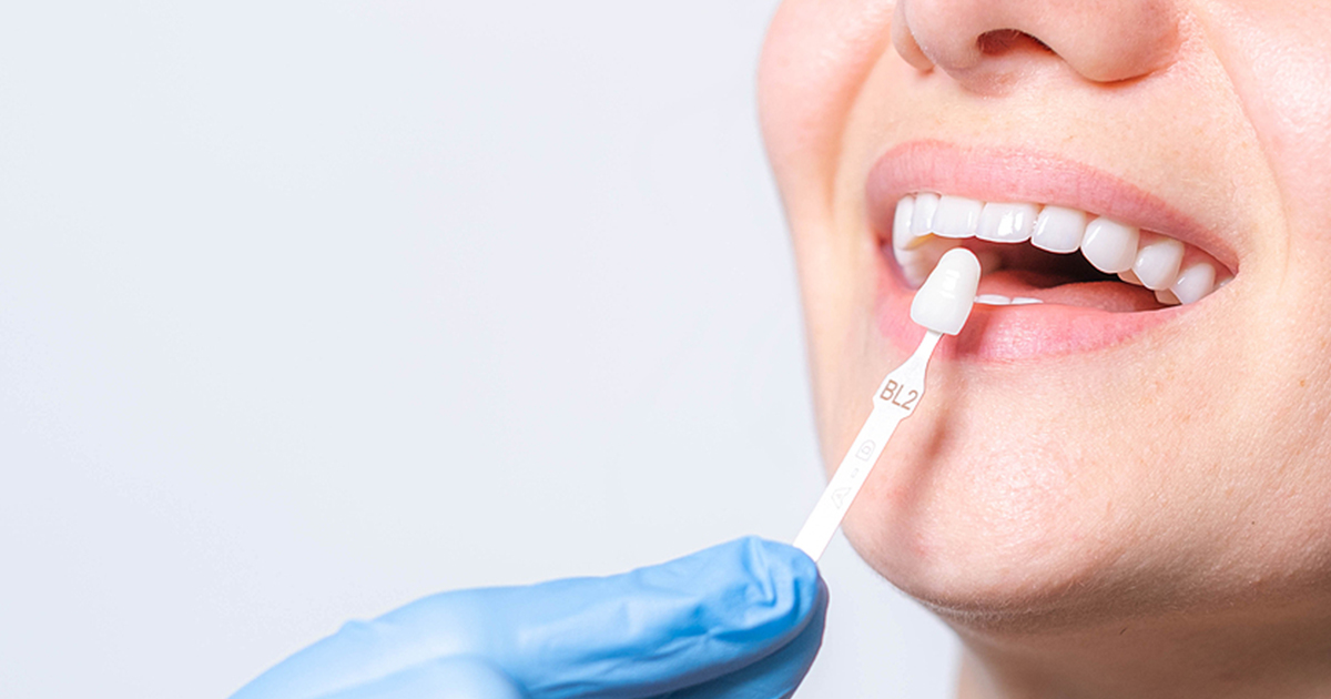 Emerald Dental - Crowns